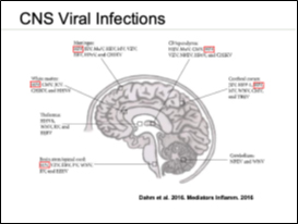 Image of a brain with text detailing CNS Viral Infections